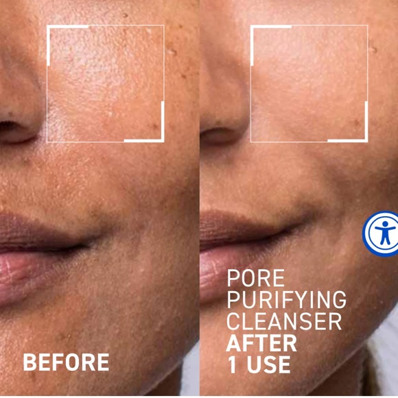 Dr Brandt PORE PURIFYING CLEANSER - Picture 2 of 5